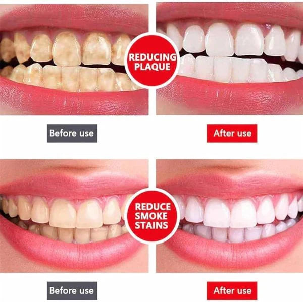 SP7 Ultra-Advanced Whitening Toothpaste — Strongest Formula Ever Made