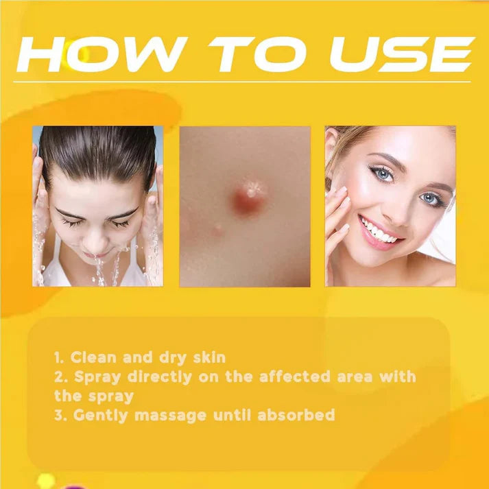 Bee Venom Skin Tag & Wart Remover Spray - Rs.999/-